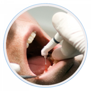 Cosmetic Dentist Beaumaris