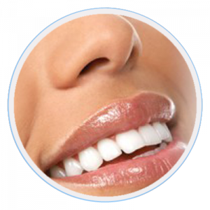 Teeth Whitening Beaumaris