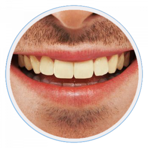 Cosmetic Dentist Mentone