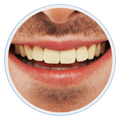 MC-SmileDesign02_400x400_v02 Cosmetic Dentist Mentone
