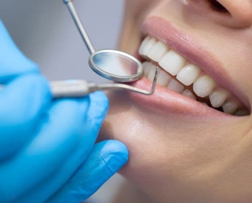dental-implants-blog-1