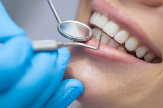 dental-implants-blog-1