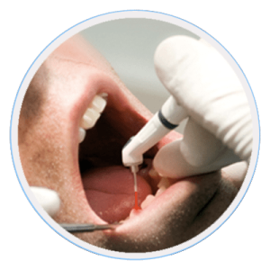 cosmetic dentistry parkdale