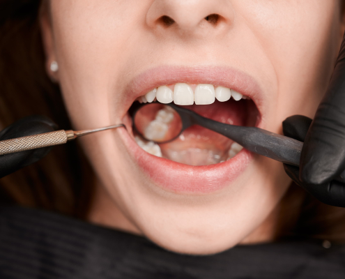 teeth-grinding