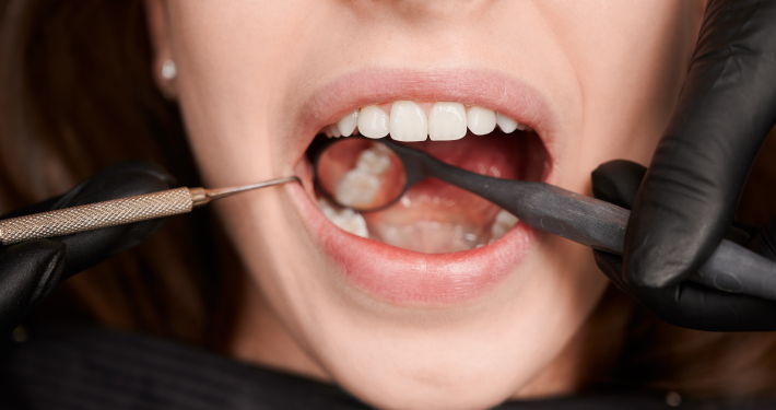 teeth-grinding
