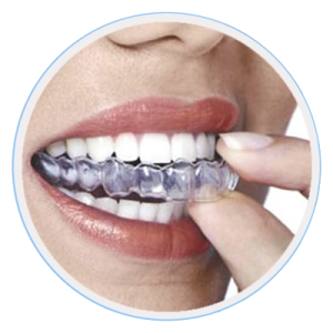 Invisalign Melbourne -Clear Aligners & Braces